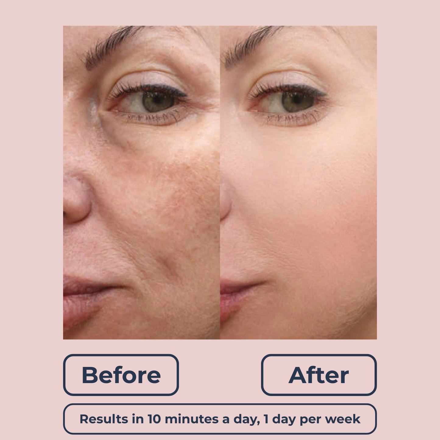 Lutique™ Contour Tool