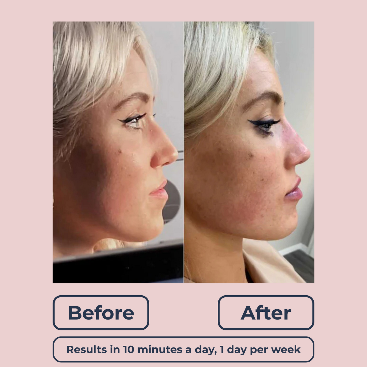 Lutique™ Original 6in1 FaceSculpt