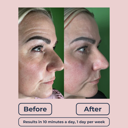 Lutique™ K-Derm Antiwrinkle Patches