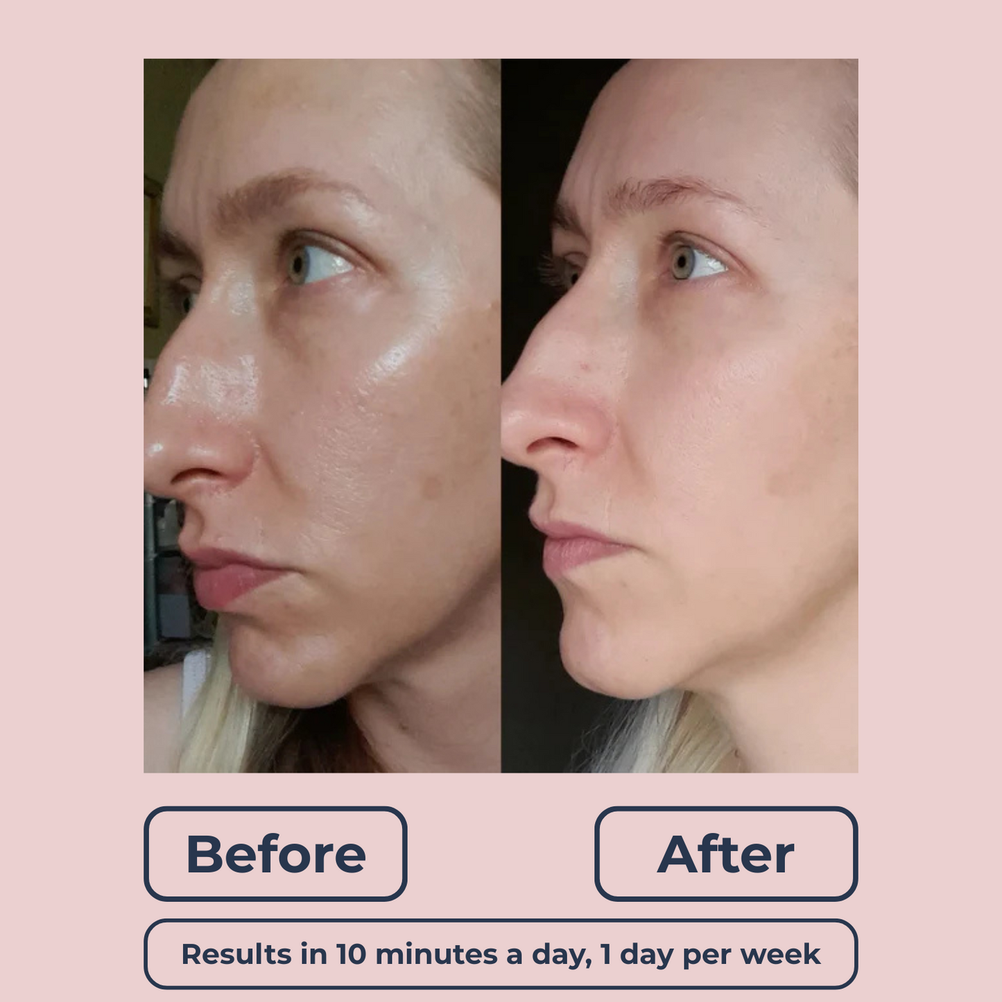 Lutique™ Dermaclear Hydrator Pro