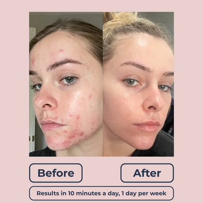 Lutique™ Original 6in1 FaceSculpt