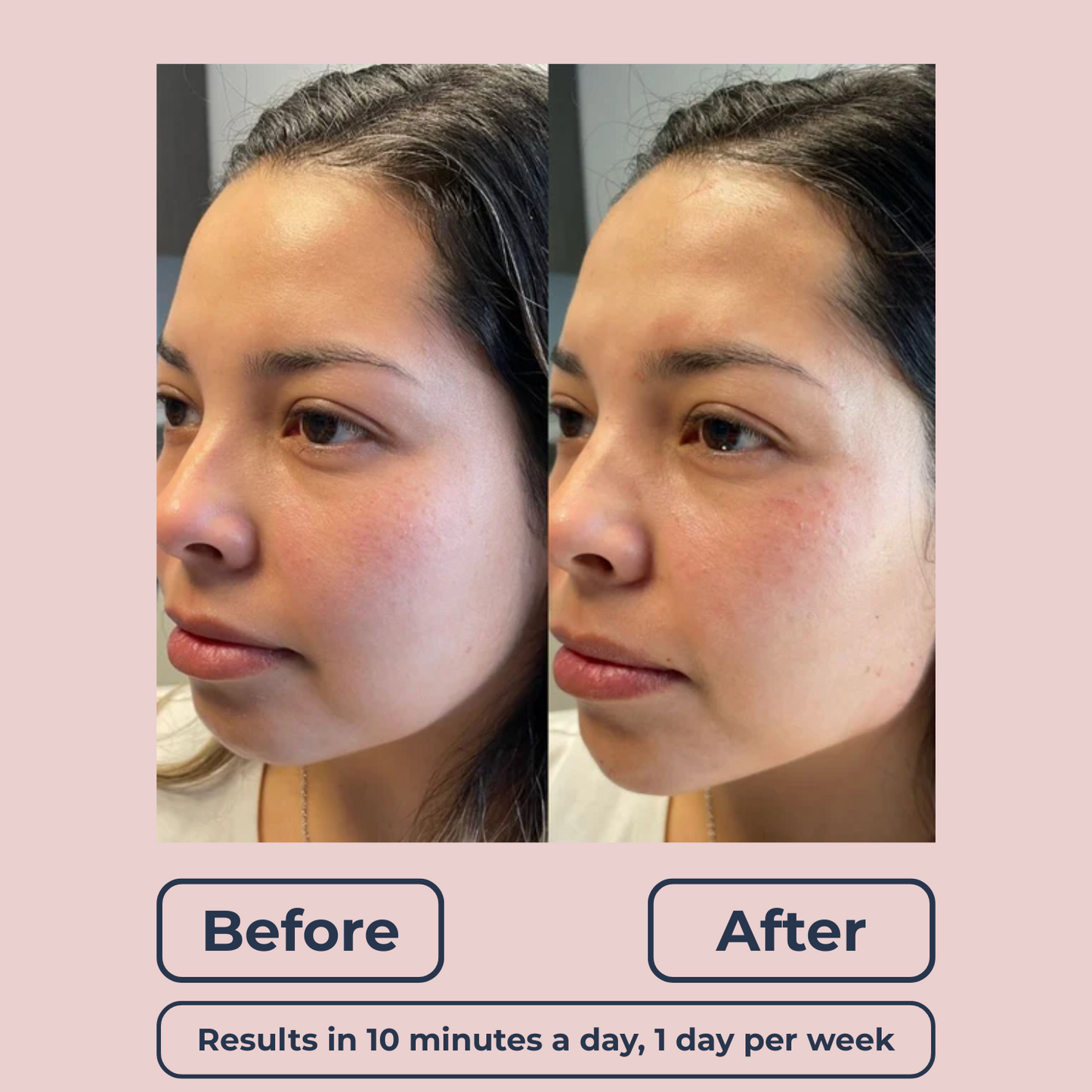 Lutique™ 6in1 FaceSculpt Pro