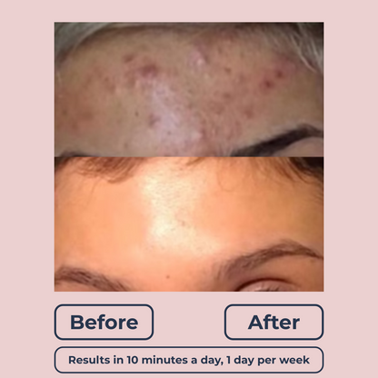 Lutique™ Dermaclear Hydrator Pro
