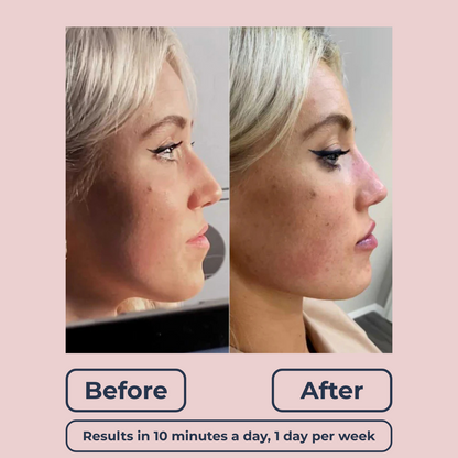 Lutique™ Original 6in1 FaceSculpt