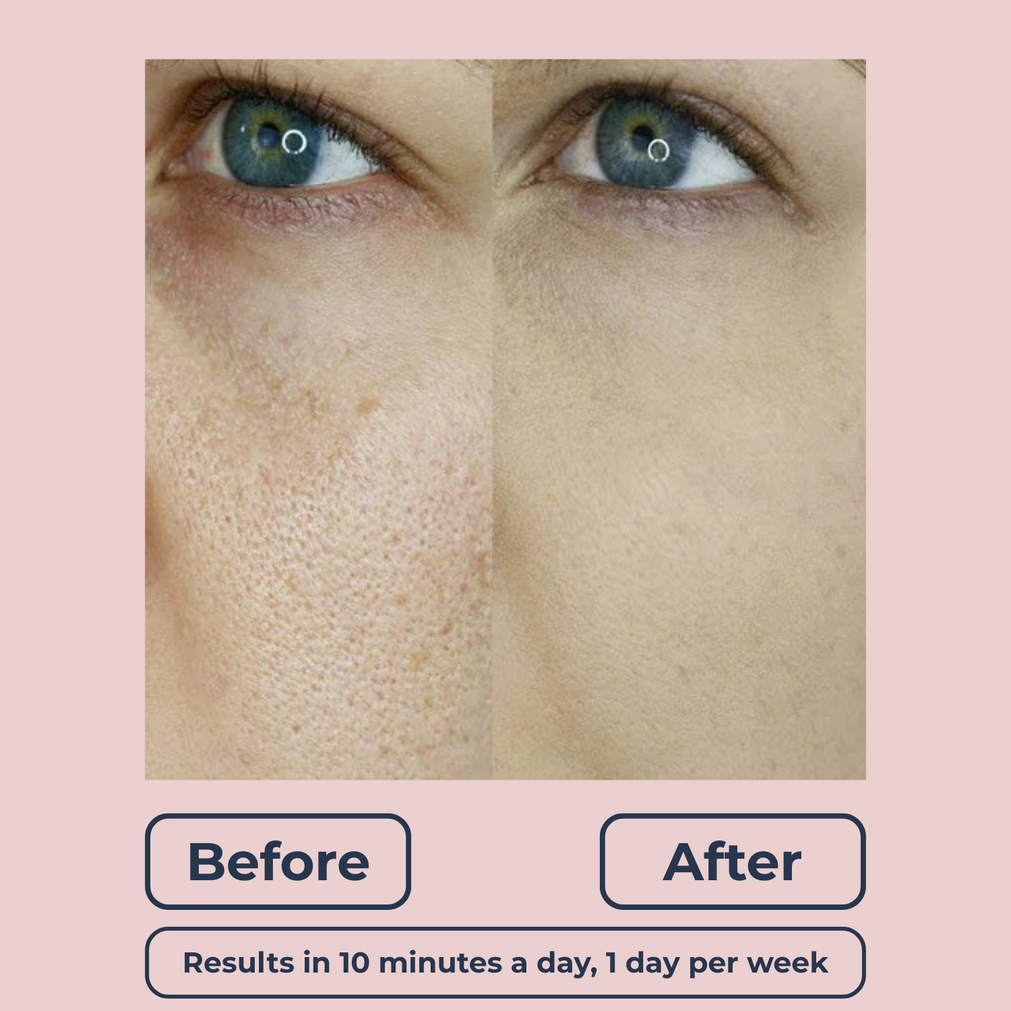 Lutique™ Dermaclear Hydrator Pro
