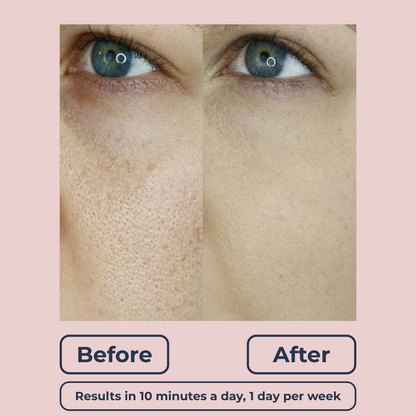Lutique™ Dermaclear Hydrator Pro