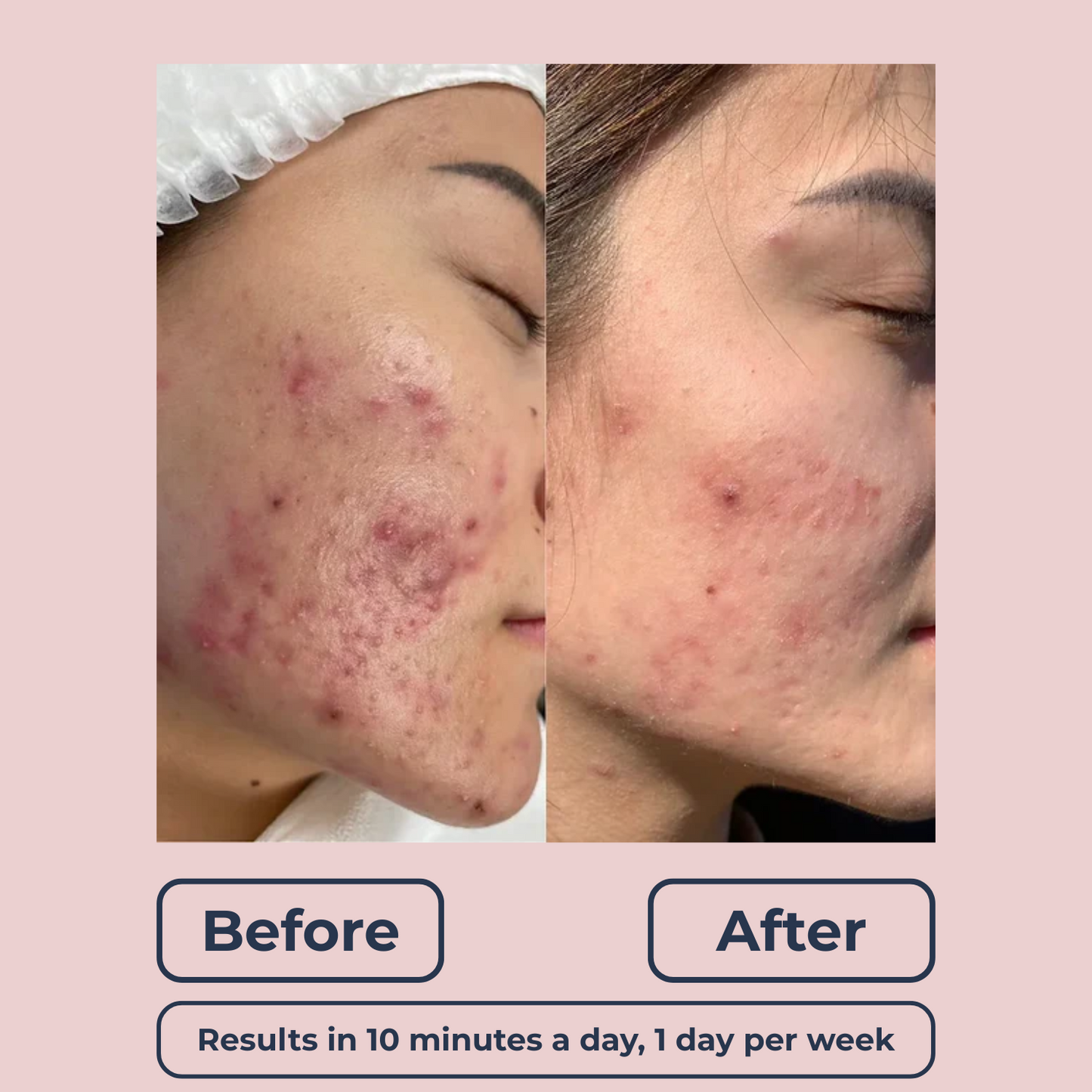 Lutique™ 6in1 FaceSculpt Pro